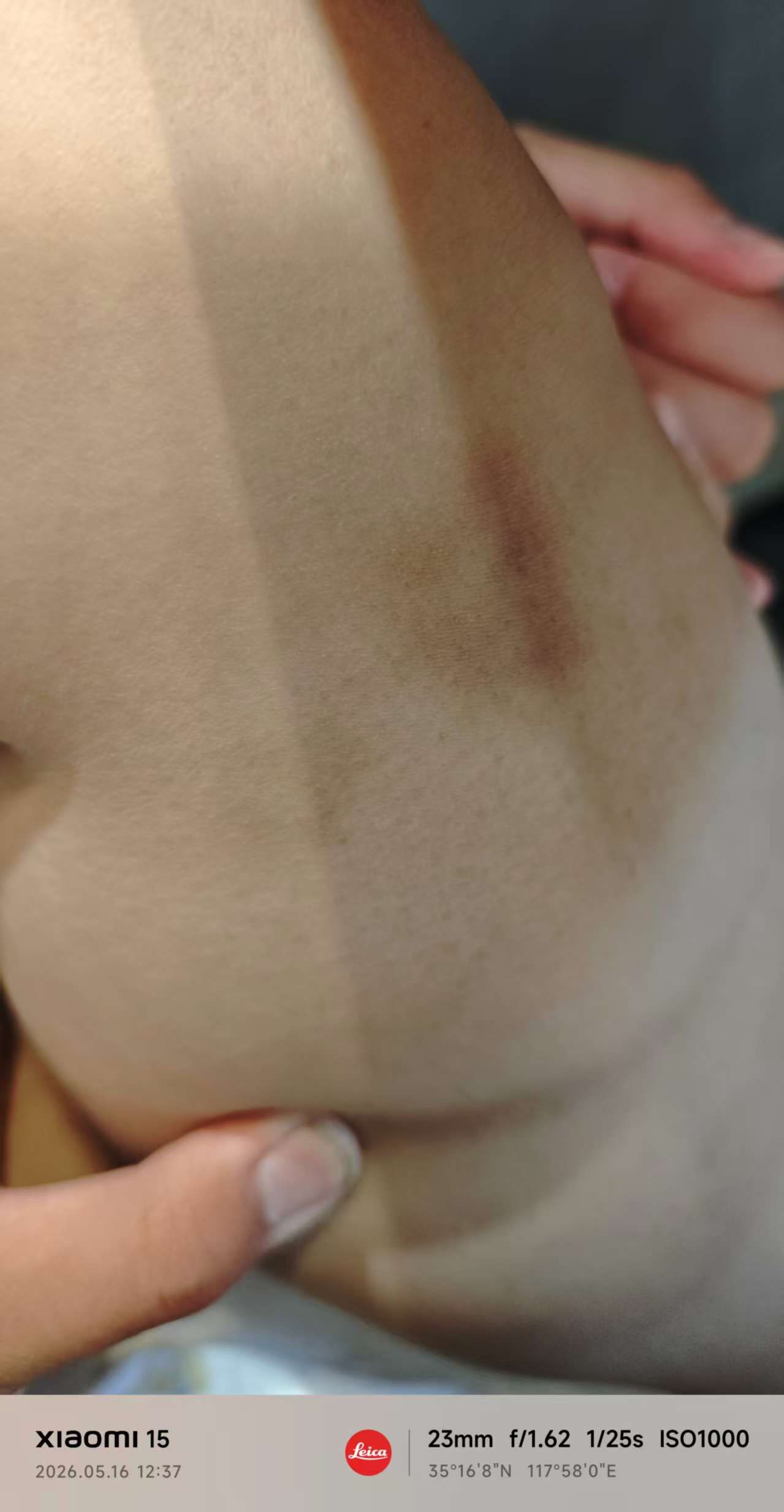 舆情
